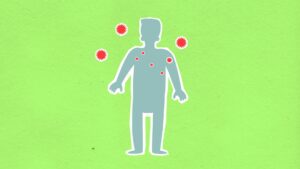 measles outbreak health — Photo by Monstera Production on Pexels